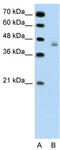 DExH-Box Helicase 30 antibody, TA341628, Origene, Western Blot image 