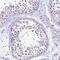 DEAH-Box Helicase 15 antibody, NBP2-13919, Novus Biologicals, Immunohistochemistry paraffin image 