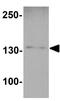 Ski2 Like RNA Helicase antibody, GTX31599, GeneTex, Western Blot image 