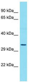 Olfactory Receptor Family 52 Subfamily D Member 1 antibody, TA334898, Origene, Western Blot image 