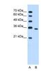 Phosphoribosyl Pyrophosphate Synthetase 2 antibody, NBP1-56666, Novus Biologicals, Western Blot image 