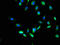 Mannose-P-Dolichol Utilization Defect 1 antibody, A62970-100, Epigentek, Immunofluorescence image 