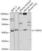 P2Y purinoceptor 4 antibody, GTX54638, GeneTex, Western Blot image 