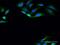 Pantothenate Kinase 4 antibody, H00055229-D01P, Novus Biologicals, Immunofluorescence image 