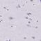 Sperm Acrosome Associated 4 antibody, PA5-63946, Invitrogen Antibodies, Immunohistochemistry paraffin image 
