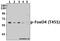 Forkhead Box O4 antibody, A01819T451, Boster Biological Technology, Western Blot image 