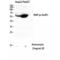 X-Linked Inhibitor Of Apoptosis antibody, LS-C381277, Lifespan Biosciences, Western Blot image 