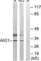 Androgen Induced 1 antibody, TA315474, Origene, Western Blot image 