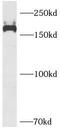 Platelet Derived Growth Factor Receptor Beta antibody, FNab06266, FineTest, Western Blot image 