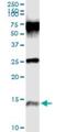 PI3 antibody, H00005266-M02, Novus Biologicals, Immunoprecipitation image 