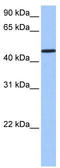 Sterile Alpha Motif Domain Containing 14 antibody, TA337550, Origene, Western Blot image 