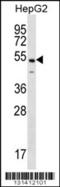 NFKB Activating Protein antibody, 56-401, ProSci, Western Blot image 