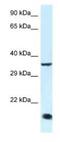 Kruppel Like Factor 3 antibody, NBP1-82403, Novus Biologicals, Western Blot image 