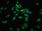 Aconitase 1 antibody, LS-C670515, Lifespan Biosciences, Immunofluorescence image 