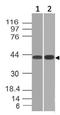 Cytokine receptor-like factor 2 antibody, M04167, Boster Biological Technology, Western Blot image 
