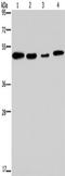 Phosphorylase Kinase Catalytic Subunit Gamma 2 antibody, TA351527, Origene, Western Blot image 