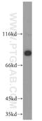 Adseverin antibody, 11579-1-AP, Proteintech Group, Western Blot image 