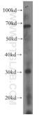 E3 ubiquitin-protein ligase MARCH5 antibody, 12213-1-AP, Proteintech Group, Western Blot image 