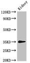 Phosphoribosyl Pyrophosphate Synthetase 2 antibody, CSB-PA018779LA01HU, Cusabio, Western Blot image 
