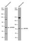 Methylenetetrahydrofolate reductase antibody, PA5-27211, Invitrogen Antibodies, Western Blot image 