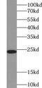 Pre-rRNA-processing protein TSR2 homolog antibody, FNab09071, FineTest, Western Blot image 