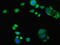 Phosphatidate cytidylyltransferase, mitochondrial antibody, LS-C676573, Lifespan Biosciences, Immunofluorescence image 