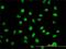Myoneurin antibody, H00055892-M01, Novus Biologicals, Immunocytochemistry image 