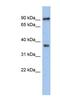 Radial Spoke Head 10 Homolog B2 antibody, NBP1-56466, Novus Biologicals, Western Blot image 