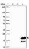 Zinc Finger Protein 813 antibody, PA5-63296, Invitrogen Antibodies, Western Blot image 