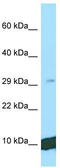 Cytochrome b-c1 complex subunit 8 antibody, TA334394, Origene, Western Blot image 