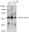 Chitinase 3 Like 1 antibody, GTX55570, GeneTex, Western Blot image 