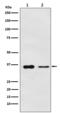 PDZ and LIM domain protein 1 antibody, M04832, Boster Biological Technology, Western Blot image 