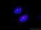 Proteasome 26S Subunit, ATPase 4 antibody, 11389-1-AP, Proteintech Group, Immunofluorescence image 