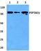 Phosphatidylinositol-4-Phosphate 5-Kinase Type 1 Gamma antibody, PA5-75549, Invitrogen Antibodies, Western Blot image 