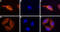 Stromal Interaction Molecule 2 antibody, GTX54768, GeneTex, Immunofluorescence image 