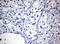 Zinc Finger E-Box Binding Homeobox 2 antibody, LS-C175748, Lifespan Biosciences, Immunohistochemistry paraffin image 