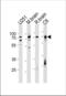 Far Upstream Element Binding Protein 1 antibody, TA324537, Origene, Western Blot image 