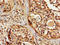 Solute Carrier Family 22 Member 17 antibody, LS-C399521, Lifespan Biosciences, Immunohistochemistry paraffin image 