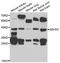 Abhydrolase Domain Containing 5 antibody, LS-C349261, Lifespan Biosciences, Western Blot image 