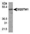 Sequestosome 1 antibody, TA336759, Origene, Western Blot image 