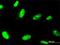 Zinc Finger Protein 81 antibody, H00347344-M07, Novus Biologicals, Immunocytochemistry image 