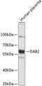 Disabled homolog 2 antibody, 19-173, ProSci, Western Blot image 
