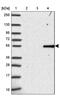Bardet-Biedl Syndrome 1 antibody, PA5-63546, Invitrogen Antibodies, Western Blot image 