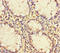 PCF11 Cleavage And Polyadenylation Factor Subunit antibody, LS-C678945, Lifespan Biosciences, Immunohistochemistry paraffin image 