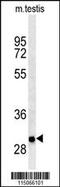 Nicotinamide Riboside Kinase 2 antibody, 61-507, ProSci, Western Blot image 