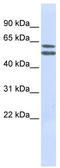 Phosphatidylinositol Glycan Anchor Biosynthesis Class Q antibody, TA339399, Origene, Western Blot image 