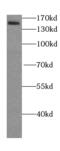 Lysine Demethylase 3A antibody, FNab04510, FineTest, Western Blot image 