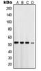 Presenilin 1 antibody, LS-C352736, Lifespan Biosciences, Western Blot image 