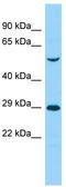 Endonuclease Domain Containing 1 antibody, TA333853, Origene, Western Blot image 