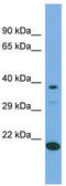 Lipoyl(Octanoyl) Transferase 2 antibody, TA331040, Origene, Western Blot image 
